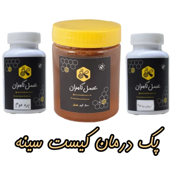 پکیج درمان کیست سینه